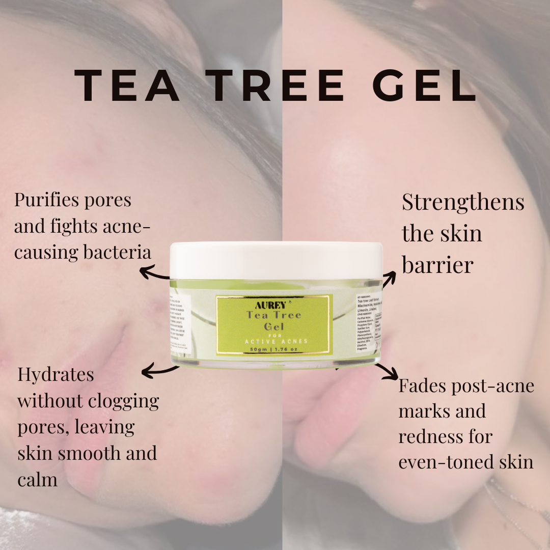 Aurey Tea Tree Gel 50gm