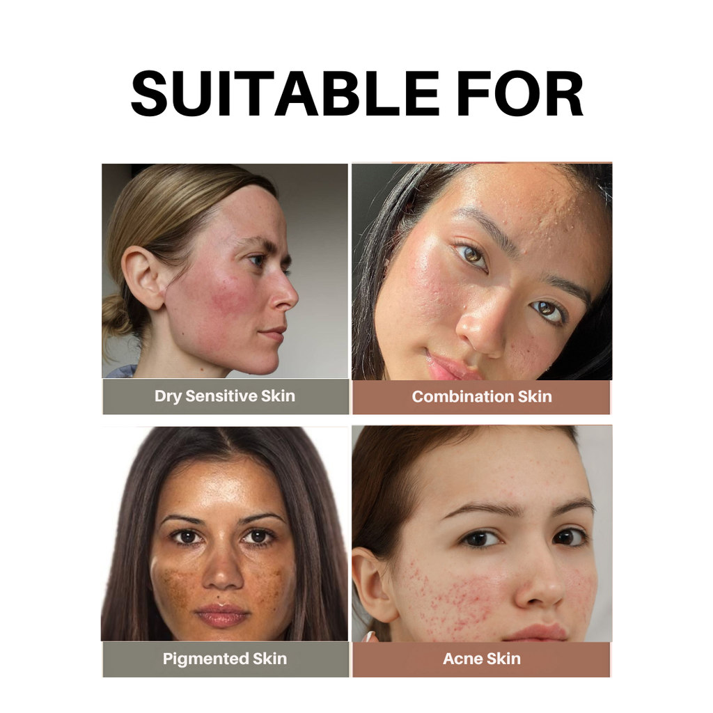 Aurey Korean Rice Pack with Niacinemide and Rice Extracts 50gm