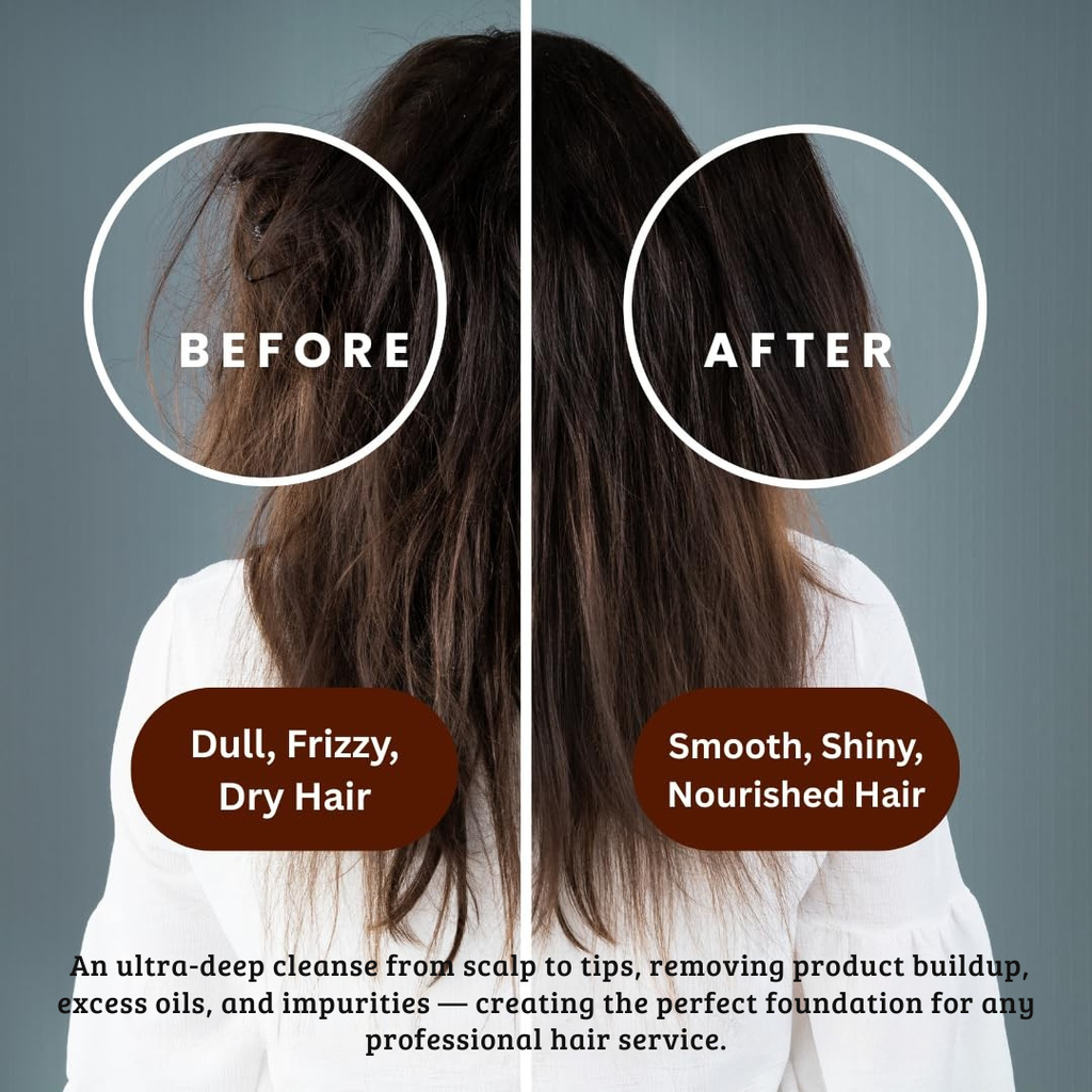 Aurey Clarifying Pro Shampoo with Aloe-vera & D-Panthenol 5000 ml